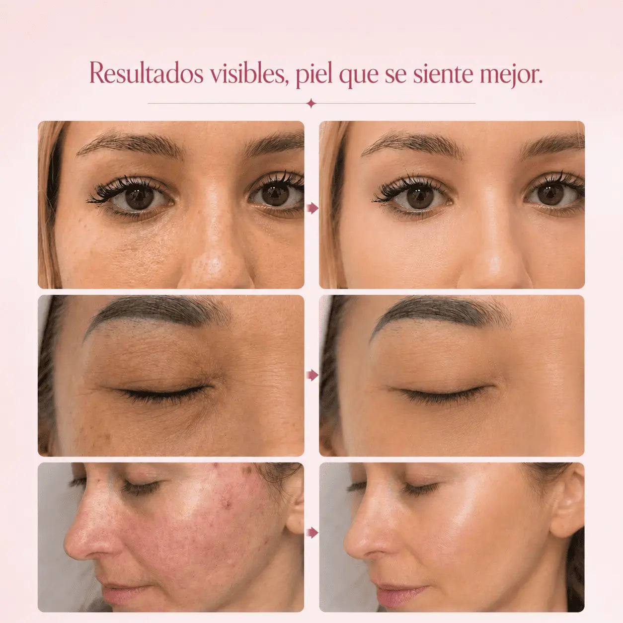 SOLENNE™ Bálsamo Voluminizador con PDRN + Colágeno Vórtice Store