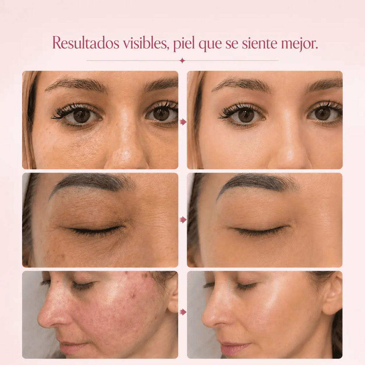 SOLENNE™ Bálsamo Voluminizador con PDRN + Colágeno Vórtice Store